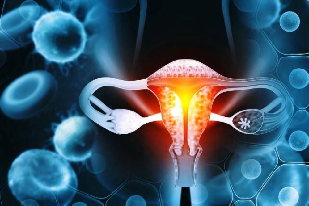 Cancer de l'endomètre: feu vert européen pour un traitement de GSK