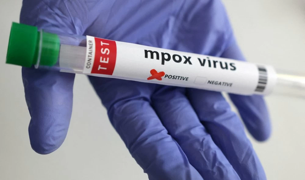 A test tube labelled "Mpox virus positive" is held in this illustration taken August 20, 2024. REUTERS/Dado Ruvic/Illustration